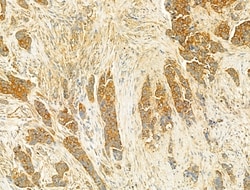 PIK3CA Polyclonal Antibody:Antibodies, Polyclonal