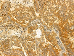 PIK3CA Polyclonal Antibody:Antibodies, Polyclonal