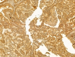 PIK3CA Polyclonal Antibody:Antibodies, Polyclonal