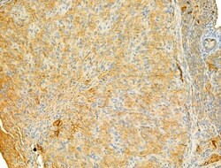 PIK3CA Polyclonal Antibody:Antibodies, Polyclonal
