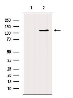PIK3CA Polyclonal Antibody:Antibodies, Polyclonal