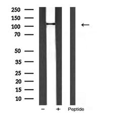 PIK3CA Polyclonal Antibody:Antibodies, Polyclonal