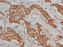 Invitrogen BMP-3 Polyclonal Antibody 100 &mu;L; Unconjugated:Antibodies,
