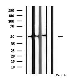 Invitrogen BMP-3 Polyclonal Antibody 100 &mu;L; Unconjugated:Antibodies,