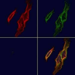Invitrogen CD103 Polyclonal Antibody 100 &mu;L; Unconjugated:Antibodies,
