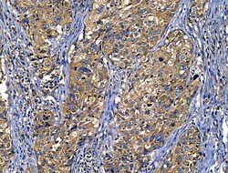 Invitrogen CD103 Polyclonal Antibody 100 &mu;L; Unconjugated:Antibodies,