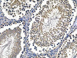 Invitrogen CD103 Polyclonal Antibody 100 &mu;L; Unconjugated:Antibodies,