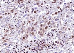 Invitrogen SMAD6 Polyclonal Antibody 100 &mu;L; Unconjugated:Antibodies,