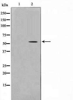 Invitrogen SMAD6 Polyclonal Antibody 100 &mu;L; Unconjugated:Antibodies,