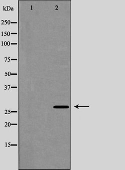 Invitrogen Aquaporin 5 Polyclonal Antibody 100 &mu;L | Buy Online | Invitrogen&trade; | Fisher Scientific