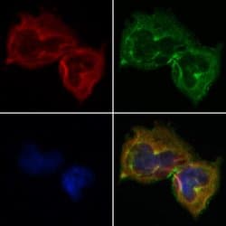 Invitrogen SERPINB2 Polyclonal Antibody 100 &mu;L; Unconjugated:Antibodies,
