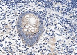 Invitrogen SERPINB2 Polyclonal Antibody 100 &mu;L; Unconjugated:Antibodies,