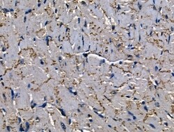 Invitrogen SERPINB2 Polyclonal Antibody 100 &mu;L; Unconjugated:Antibodies,