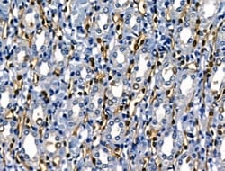 Invitrogen SERPINB2 Polyclonal Antibody 100 &mu;L; Unconjugated:Antibodies,