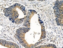 Invitrogen PDGF-A Polyclonal Antibody 100 &mu;L; Unconjugated:Antibodies,