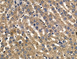 Invitrogen PDGF-A Polyclonal Antibody 100 &mu;L; Unconjugated:Antibodies,
