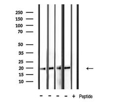 Invitrogen PDGF-A Polyclonal Antibody 100 &mu;L; Unconjugated:Antibodies,