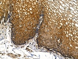 Invitrogen ITGA3 Polyclonal Antibody 100 &mu;L | Buy Online | Invitrogen&trade; | Fisher Scientific