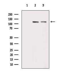 Invitrogen ITGA3 Polyclonal Antibody 100 &mu;L | Buy Online | Invitrogen&trade; | Fisher Scientific