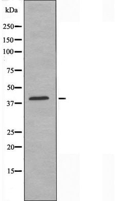 Invitrogen RUNX3 Polyclonal Antibody 100 &mu;L; Unconjugated:Antibodies,