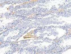 Invitrogen Claudin 6 Polyclonal Antibody 100 &mu;L; Unconjugated:Antibodies,