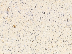 Invitrogen Claudin 6 Polyclonal Antibody 100 &mu;L; Unconjugated:Antibodies,