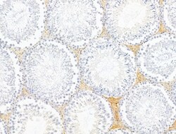 Invitrogen Claudin 6 Polyclonal Antibody 100 &mu;L; Unconjugated:Antibodies,