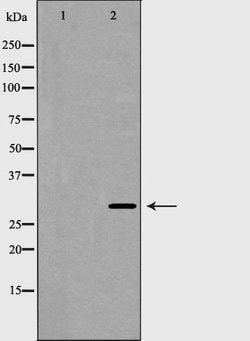 HOXB5 Polyclonal Antibody:Antibodies, Polyclonal