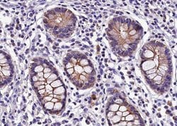 Invitrogen Claudin 5 Polyclonal Antibody 100 &mu;L; Unconjugated:Antibodies,