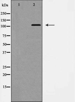Invitrogen EphB1 Polyclonal Antibody 100 &mu;L; Unconjugated:Antibodies,