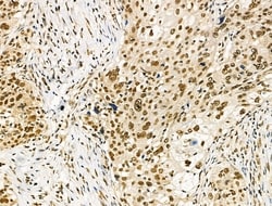 Invitrogen hnRNP H1 Polyclonal Antibody 100 &mu;L; Unconjugated:Antibodies,