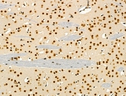 Invitrogen hnRNP H1 Polyclonal Antibody 100 &mu;L; Unconjugated:Antibodies,
