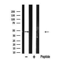 Invitrogen hnRNP H1 Polyclonal Antibody 100 &mu;L; Unconjugated:Antibodies,