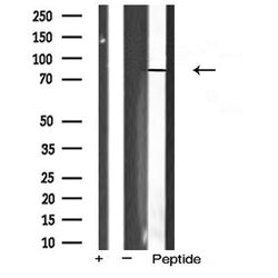 Invitrogen FSHR Polyclonal Antibody 100 &mu;L; Unconjugated:Antibodies,