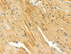 Invitrogen alpha Actinin 2/3 Polyclonal Antibody 100 &mu;L; Unconjugated:Antibodies,