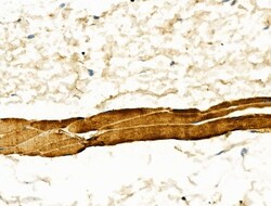 Invitrogen alpha Actinin 2/3 Polyclonal Antibody 100 &mu;L; Unconjugated:Antibodies,