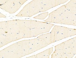 Invitrogen alpha Actinin 2/3 Polyclonal Antibody 100 &mu;L; Unconjugated:Antibodies,