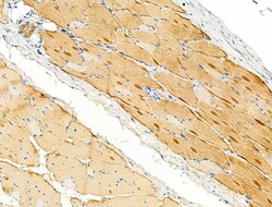 Invitrogen alpha Actinin 2/3 Polyclonal Antibody 100 &mu;L; Unconjugated:Antibodies,