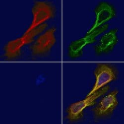 Invitrogen alpha Actinin 2/3 Polyclonal Antibody 100 &mu;L; Unconjugated:Antibodies,