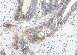Invitrogen alpha Actinin 2/3 Polyclonal Antibody 100 &mu;L; Unconjugated:Antibodies,