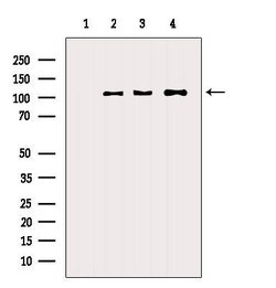 Invitrogen alpha Actinin 2/3 Polyclonal Antibody 100 &mu;L; Unconjugated:Antibodies,