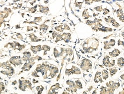 Invitrogen EphA3 Polyclonal Antibody 100 &mu;L; Unconjugated:Antibodies,