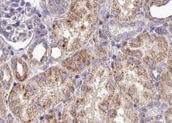 Invitrogen EphA3 Polyclonal Antibody 100 &mu;L; Unconjugated:Antibodies,