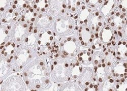 Invitrogen hnRNP L Polyclonal Antibody 100 &mu;L; Unconjugated:Antibodies,