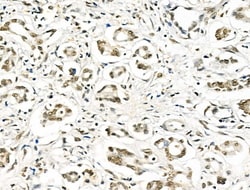 Invitrogen hnRNP C1/C2 Polyclonal Antibody 100 &mu;L; Unconjugated:Antibodies,