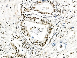 Invitrogen hnRNP C1/C2 Polyclonal Antibody 100 &mu;L; Unconjugated:Antibodies,