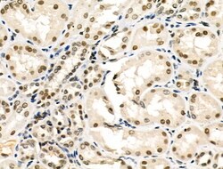 Invitrogen hnRNP C1/C2 Polyclonal Antibody 100 &mu;L; Unconjugated:Antibodies,