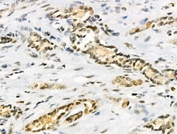 Invitrogen hnRNP C1/C2 Polyclonal Antibody 100 &mu;L; Unconjugated:Antibodies,