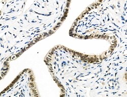 Invitrogen hnRNP C1/C2 Polyclonal Antibody 100 &mu;L; Unconjugated:Antibodies,