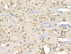 Invitrogen hnRNP C1/C2 Polyclonal Antibody 100 &mu;L; Unconjugated:Antibodies,